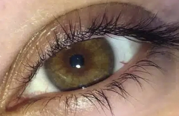 Wellness - Lash Lift - VOOR